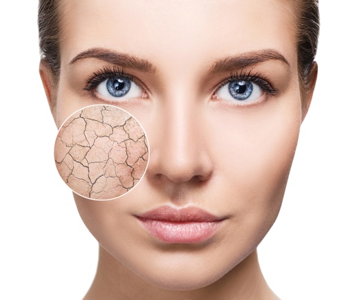 [CM-BOX-00004] FW normal to dry skin